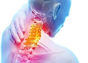 dzemdes kakla osteohondrozes cēloņi